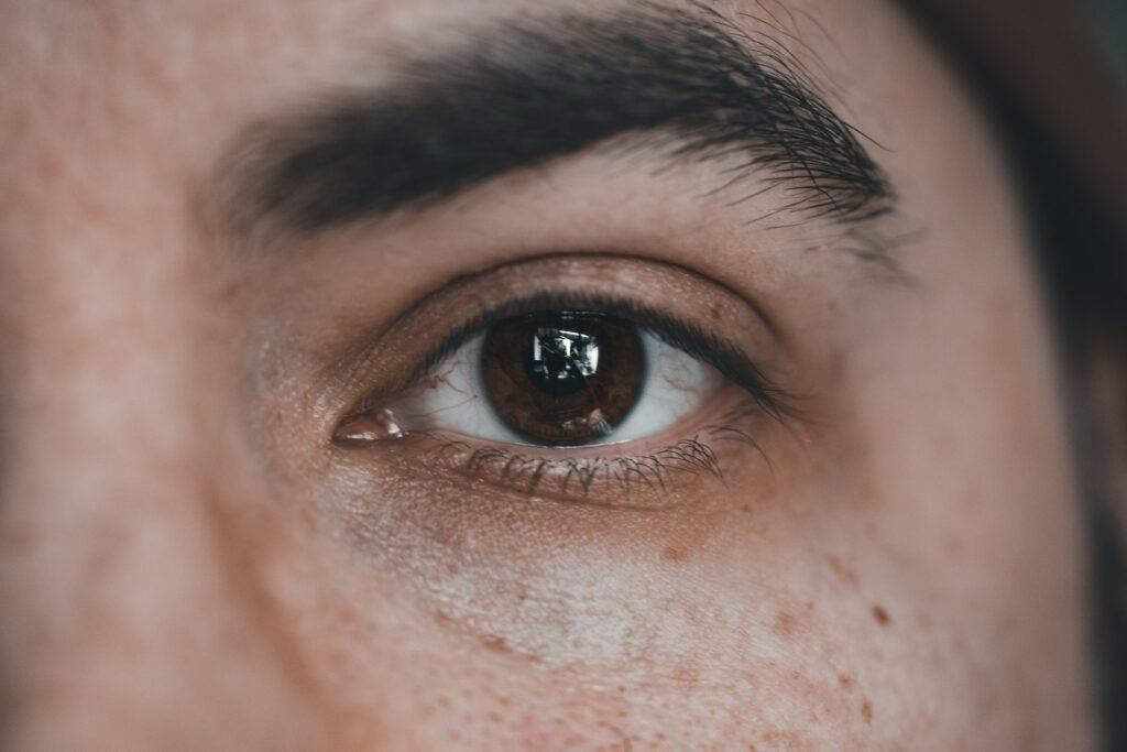 Types of Dark Circles